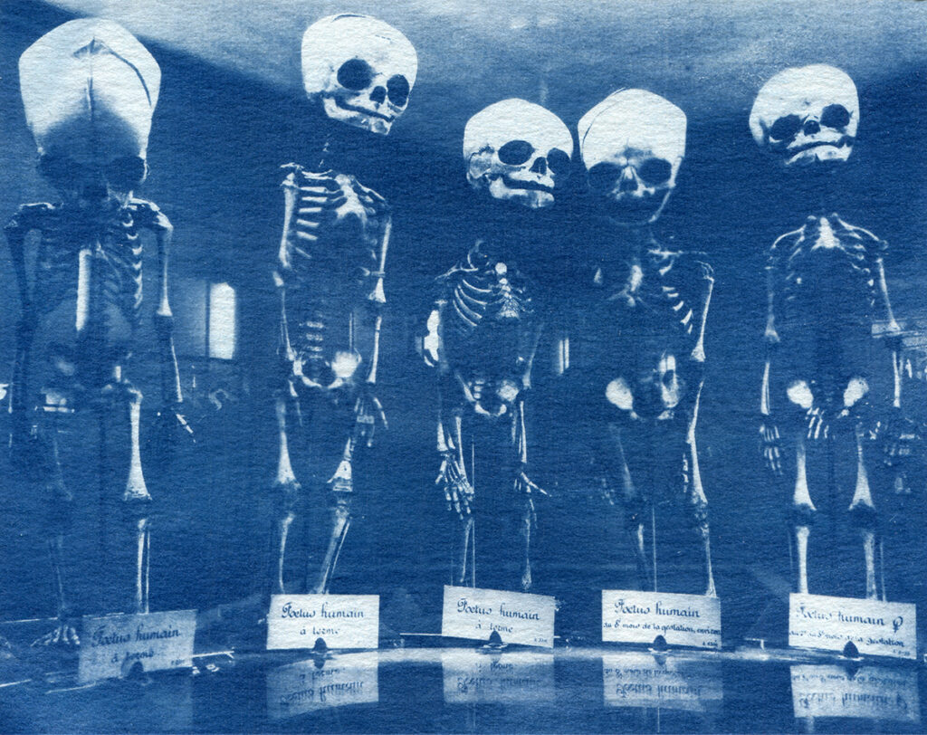 Cinq foetus humains alignés les uns à côté des autres dans la vitrine d'un musée.